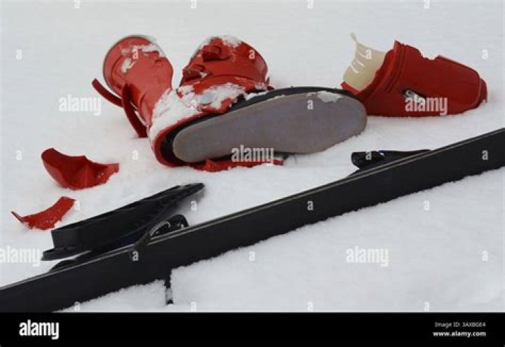 Chelsea Handler Shows Off Bare Butt Pic On Twitter After Skiing Accident – Too Much? (PHOTO)