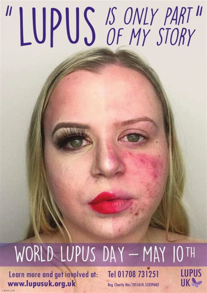 Exclusive: Beth Does Beauty founder talks about her Lupus diagnosis for World Lupus Day