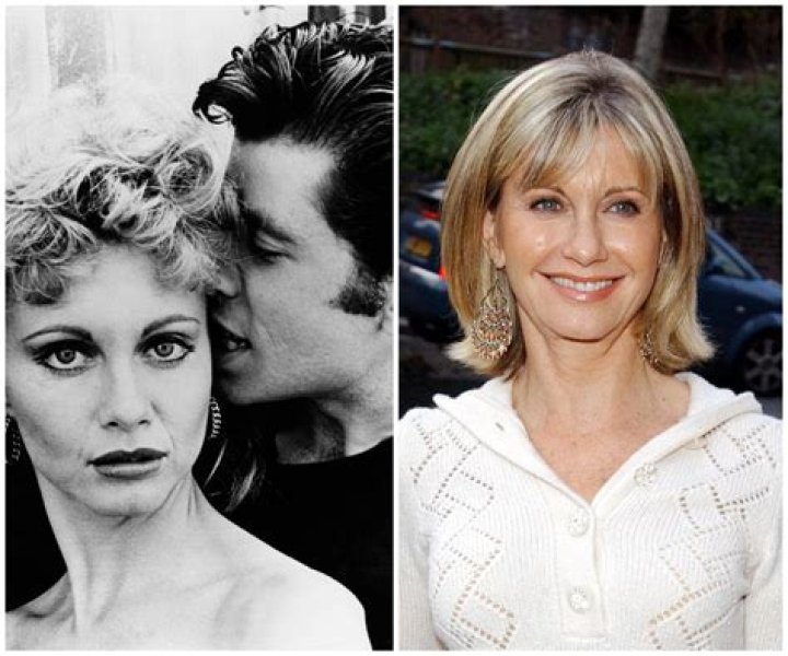 Grease star Olivia Newton-John Passed Away At The Age Of 73